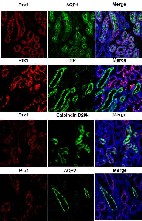 Tubule-specific expression of Prx1 in I/R-induced kidney.