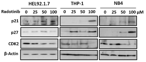 급성골수성백혈병 세포주, HEL92.1.7, THP-1, NB4에서 라도티닙에 의한 세포주기 억제 효과와 관련 단백질의 발현도