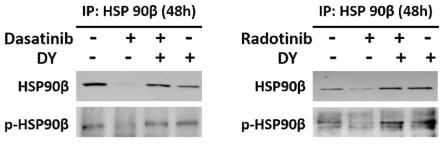 급성골수성백혈병 세포 HEL92.1.7에서 면역침강법으로 분석학 라도티닙과 다사티닙에 의한 HSP90 활성도와 발현도 감소가 Dynamin의 저해제인 DY에 의해 저해됨