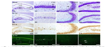 일과성 전뇌허혈 유발 후 해마 CA1, 치아이랑에서 신경세포 손상 확인