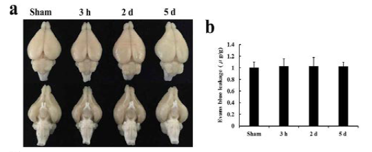 뇌허혈 후 evans blue의 뇌실질내 누출 변화