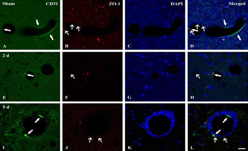 뇌허혈 후 ZO-1의 변화