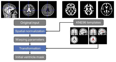 뇌실 영역 자동 분할 알고리즘의 1단계 흐름도.
