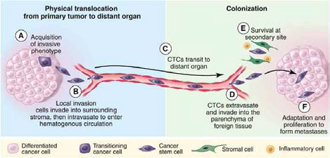 순환종양세포의 전이 과정