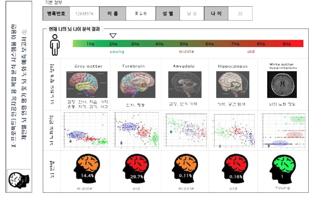 현재 뇌 나이 평가 결과 정량화 및 시각화 한 결과를 보여줌.