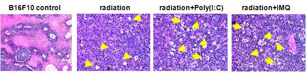 방사선 조사 전 동물 암 조직에 TLR 자극물질 투여로 인한 autophagy-induced cell death 확인.