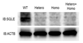 western blot analysis를 통한 타겟 단백질 발현 여부 확인 SQLE, Target gene; ACTB, House keeping gene