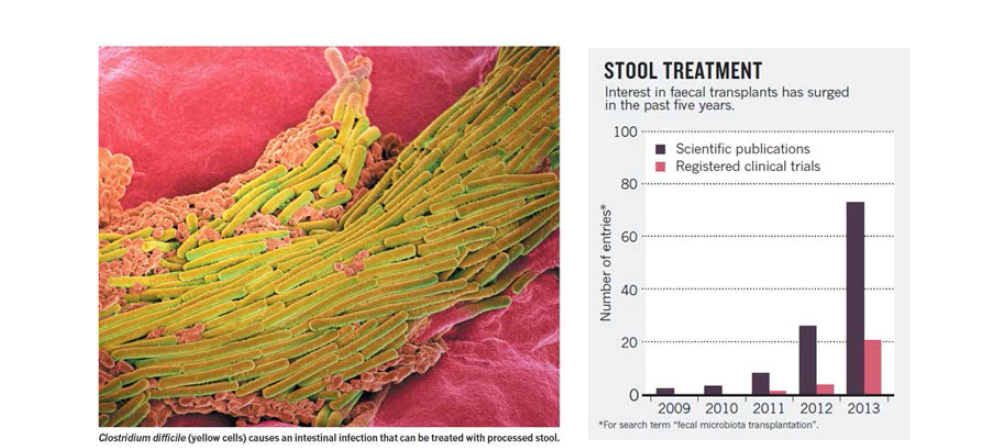 Clostridium difficile (노란색) 전자현미경 사진 및 대변이식 관련 논문 및 임상시도 증대 (Nature 2014. 02. 20. 506: 290-291)