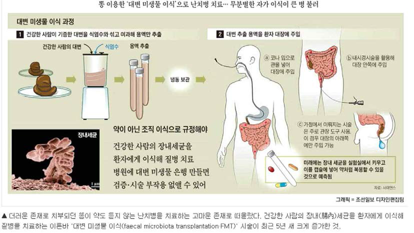 장내미생물총의 대변이식 과정 – 조선일보 2014. 03. 06 보도자료