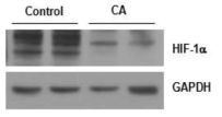 암조직에서 HIF-1α 발현