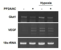PP2A에 의한 HIF-1 하위단계 유전자 발현의 감소