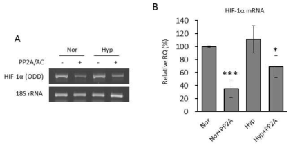 PP2A 에 의한 HIF-1α mRNA의 감소 현상