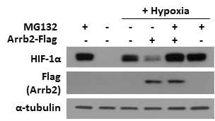 β-arrestin 2에 의해 HIF-1α stability 변화