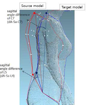 두 가지 몸통자세의 시상면(Sgittal) 각도차이에 의한 회전