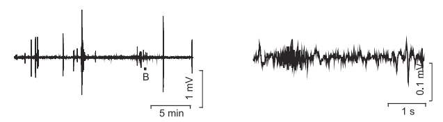 Patch pipette을 zebrafish의 optic tectum에 삽입하여 측정한 EEG 결과. 빈번한 spiking과 low level activity는 침습적 방법으로 인한 artifact로 보여짐.