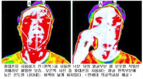 자기장 유도에 따른 인체의 열 변화