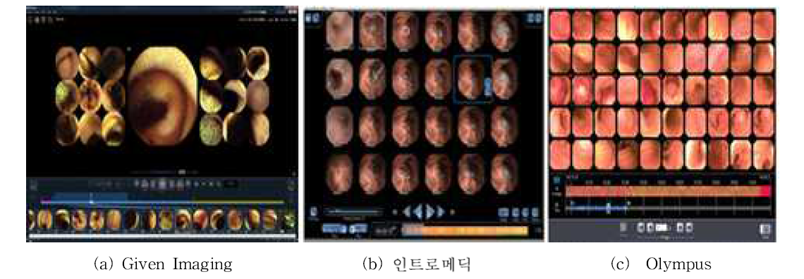 캡슐 내시경 이미지 뷰