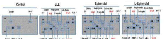 혈관 신생관련 cytokine을 western blot과 protein assay로 확인함