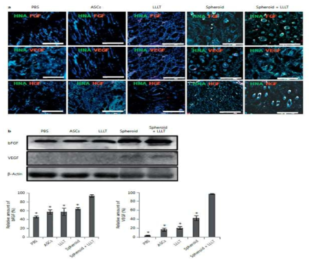 저출력 광 조사에 의한 줄기세포 스페로이드 이식체의 cytokeratin 분화