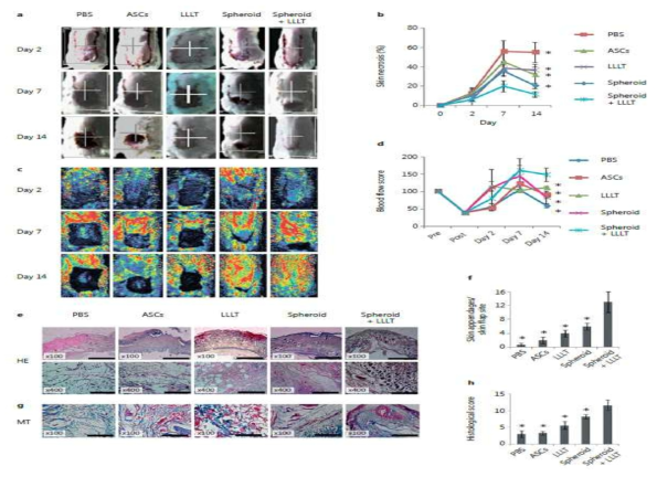 Skin flap 동물 모델에서 저출력 광 조사와 줄기세포 스페로이드에 의한 조직괴사 감소 육안적 관찰 및 혈류량 증가를 도플러 분석으로 확인함. H&E, MT staining.
