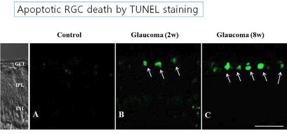 저자들의 연구 사진 : 녹내장 모델에서 망막신경절세포의 apoptosis를 TUNEL staining에서 확인