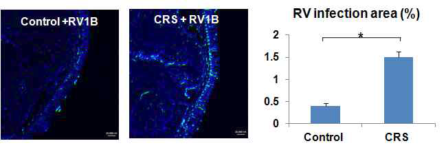 만성 부비동염(CRS) 마우스에서 정상 마우스에 비하여 RV1B 감염률이 더 높았음.