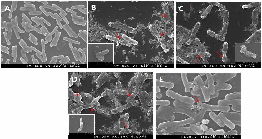 Scanning electron microscopy of Bacillus cereus treated with single and combined ethanolic extracts of lotus leaves, ginkgo leaves, and garlic cloves