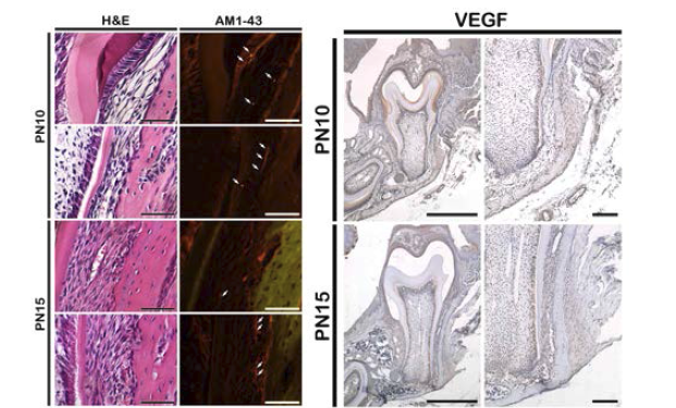 AM1-43을 미세주입한 후 희생한 신생 쥐의 치아주위조직에서의 신경분포를 형광현미경으로 관찰한 결과(왼쪽). 혈관형성인자의 발현을 확인하기 위하여 VEGF항체를 이용하여 면역조직화학기법으로 확인한 결과(오른쪽)