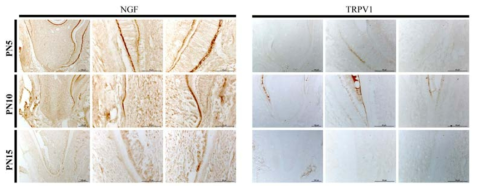 NGF와 TRPV1의 발현양상을 PN5, PN10 그리고 PN15에서 확인한 결과.