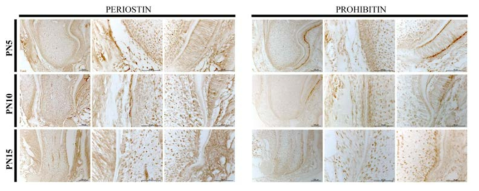 PERIOSTIN과 PROHIBITIN의 발현양상을 PN5, PN10 그리고 PN15에서 확인한 결과. 치아 및 치아주위조직 그리고 치조골에서 특이적인 발현양상을 확인할 수 있음