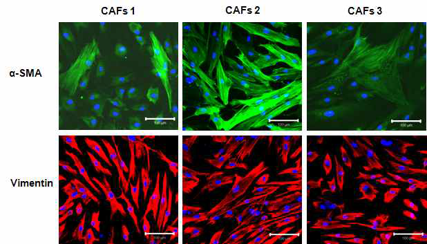 항체를 이용한 배양한 암조직 주변 섬유모세포에서의 대표적 표지자 발현