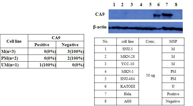 methylation 여부에 따른 CA9의 단백질 발현