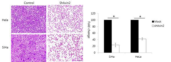 Axin2 발현양의 감소가 자궁경부암 침윤에 미치는 영향을 관찰 함