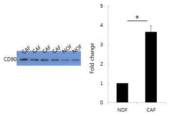체외 배양 정상 조직 유래 섬유모세포 (NOF)와 암조직 주변 섬유모세포 (CAF)에서의 CD90 단백질 발현확인