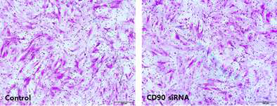 정상 구강점막 및 구강암 조직 섬유모세포에서 CD90 발현이 세포의 invasion ability에 미치는 영향 을 확인