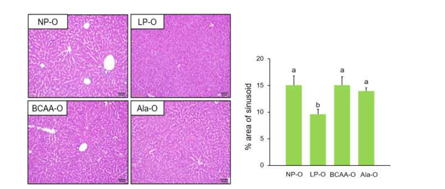 H&E staining of liver sections of PND21 male offspring from dams fed NP, LP, BCAA, and Ala diets