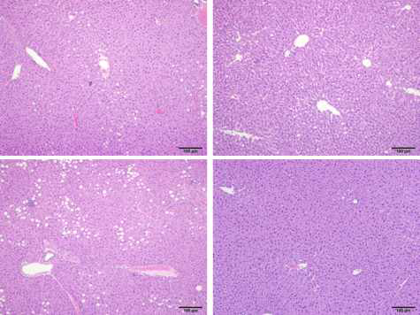 Representative H&E staining of liver tissue sections of PND105 male offspring of dams fed LF, LF+Leu, HF, and HF+Leu diets