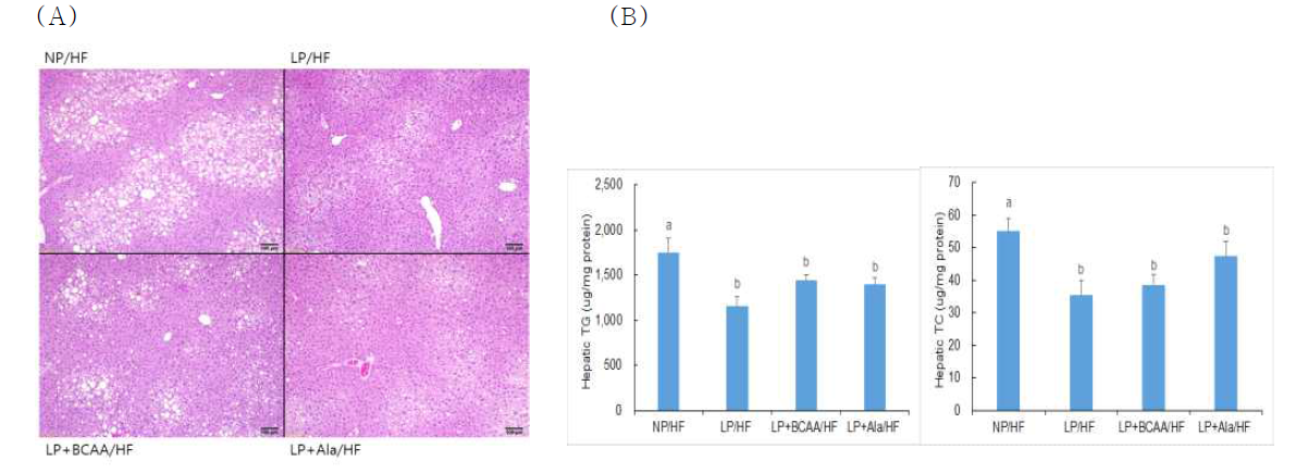 (A)H&E staining of liver tissue sections and (B)hepatic lipid levels of adult offspring of dams fed NP, LP, LP+BCAA and LP+Ala diets