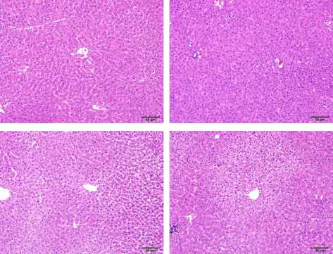 H&E staining of liver tissue sections of PND21 male offspring of dams fed LF, LF+Leu, HF, and HF+Leu diets