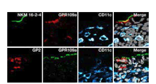 Identification of GPR109a expression in mouse M cells of terminal ileum PP