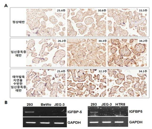 태반조직 및 세포주에서 IGFBP-5의 발현