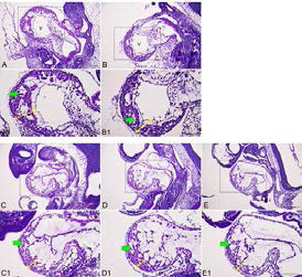 Caffeine inhibited mouse embryo ventricle wall develoment.