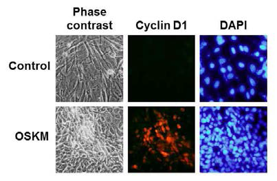 초기 리프로그래밍 단계에서의 Cyclin D1에 대한 immunocytochemical analysis.