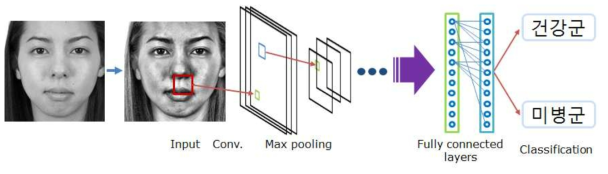 안면영상을 이용한 딥러닝 기반 미병분류