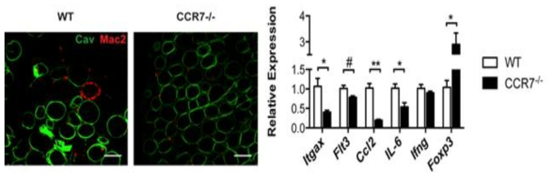 고지방사료를 섭취한 WT과 CCR7-/-쥐의 복부지방 염증