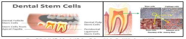 4종류의 치계줄기세포가 연골세포, 골세포, 지방세포등 다양한 세포로 분화됨.