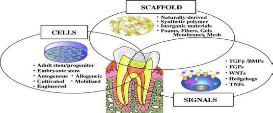 치아 및 치주조직 재생에 관련된 tissue-engineering strategy에 근거한 세 가지 주요접근