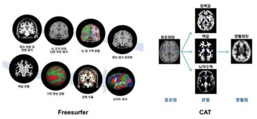 Freesurfer와 CAT을 이용한 분석의 개념도