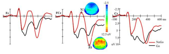 Go/Nogo task 수행시, 각각 task사이의 PTSD환자들의 N200및 P3a파형차이비교