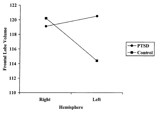 PTSD 환자군과 정상군의 좌우 전두엽 부피의 비대칭성